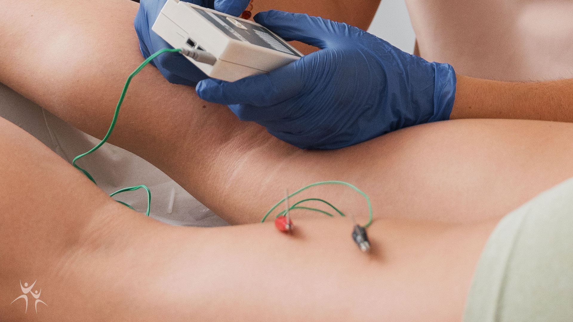 Electro-dry-needling