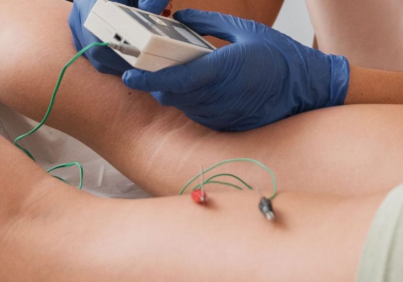 Electro-dry-needling